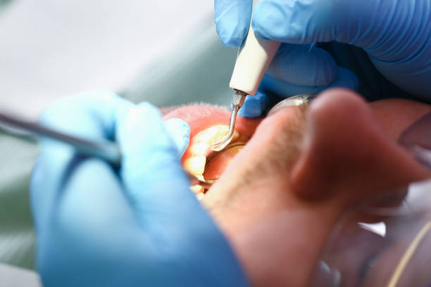 Best Emergency Dentist for Lost Fillings or Crowns in Shell Valley, ND
