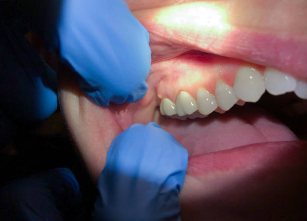 Best Emergency Dentist for Knocked-Out Tooth in Shell Valley, ND