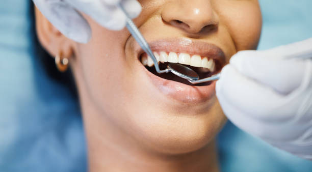 Best Emergency Dental Services for Seniors in Shell Valley, ND