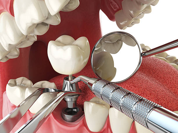 Best Emergency Cosmetic Dentistry in Shell Valley, ND